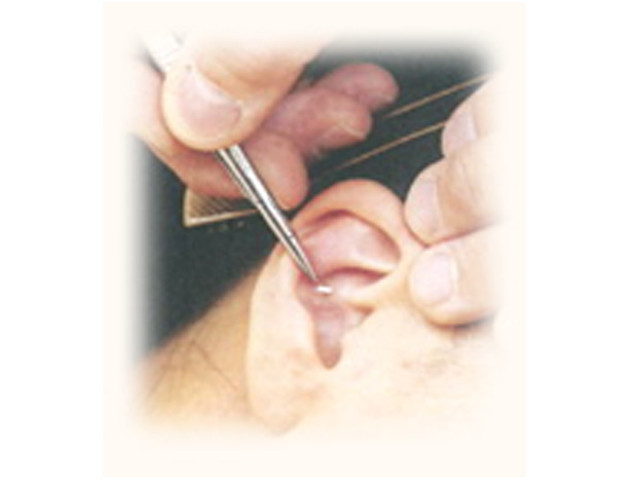 耳ツボダイエット鍼治療で‼️大田区長原の鍼灸整体武治療院にご相談下さい。